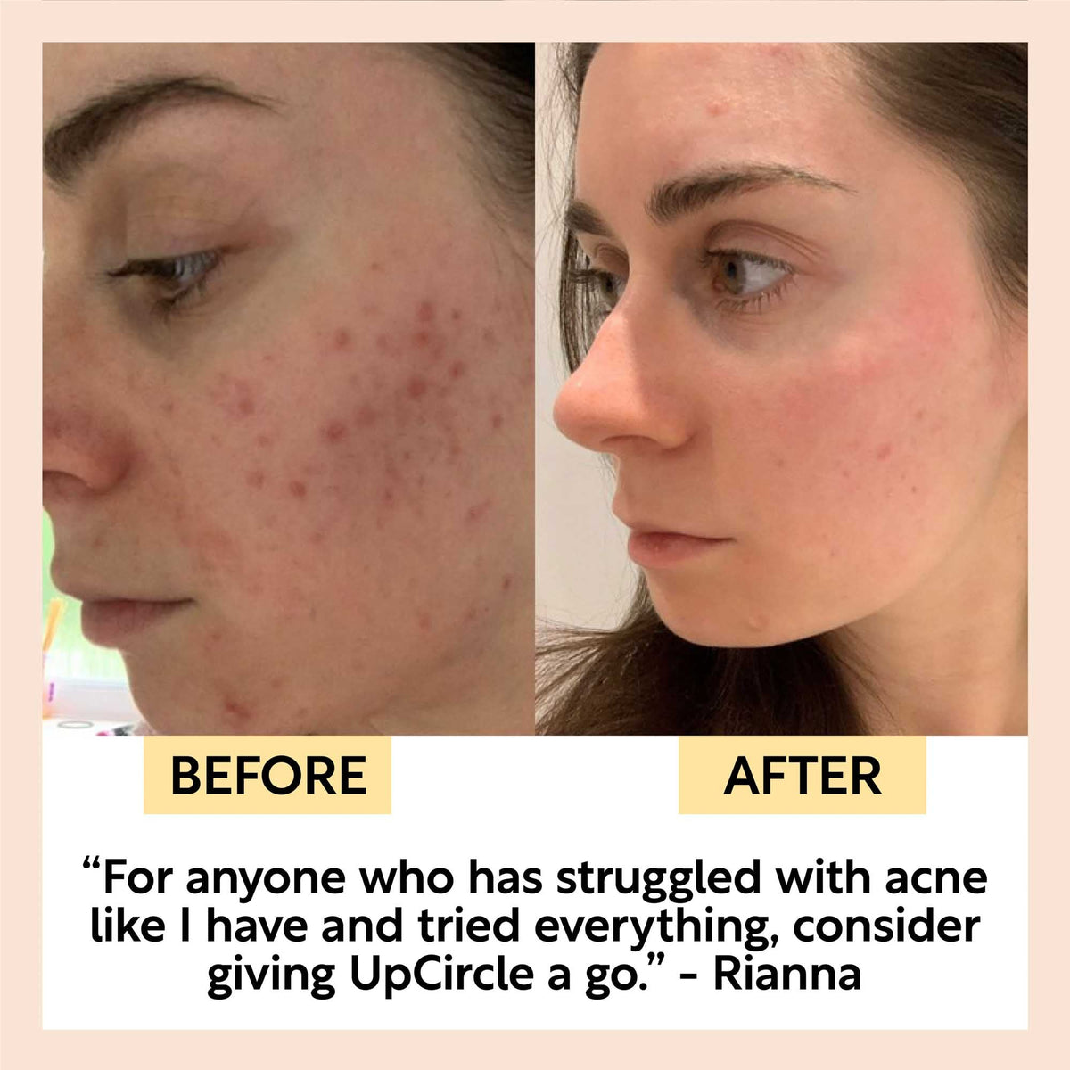 Face Toner with Hyaluronic Acid - Travel Size