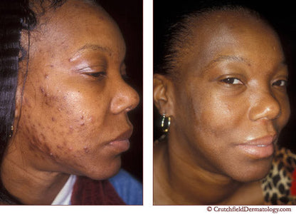 Organic Turmeric Clay Facial Mask/TONING, DARK SPOTS